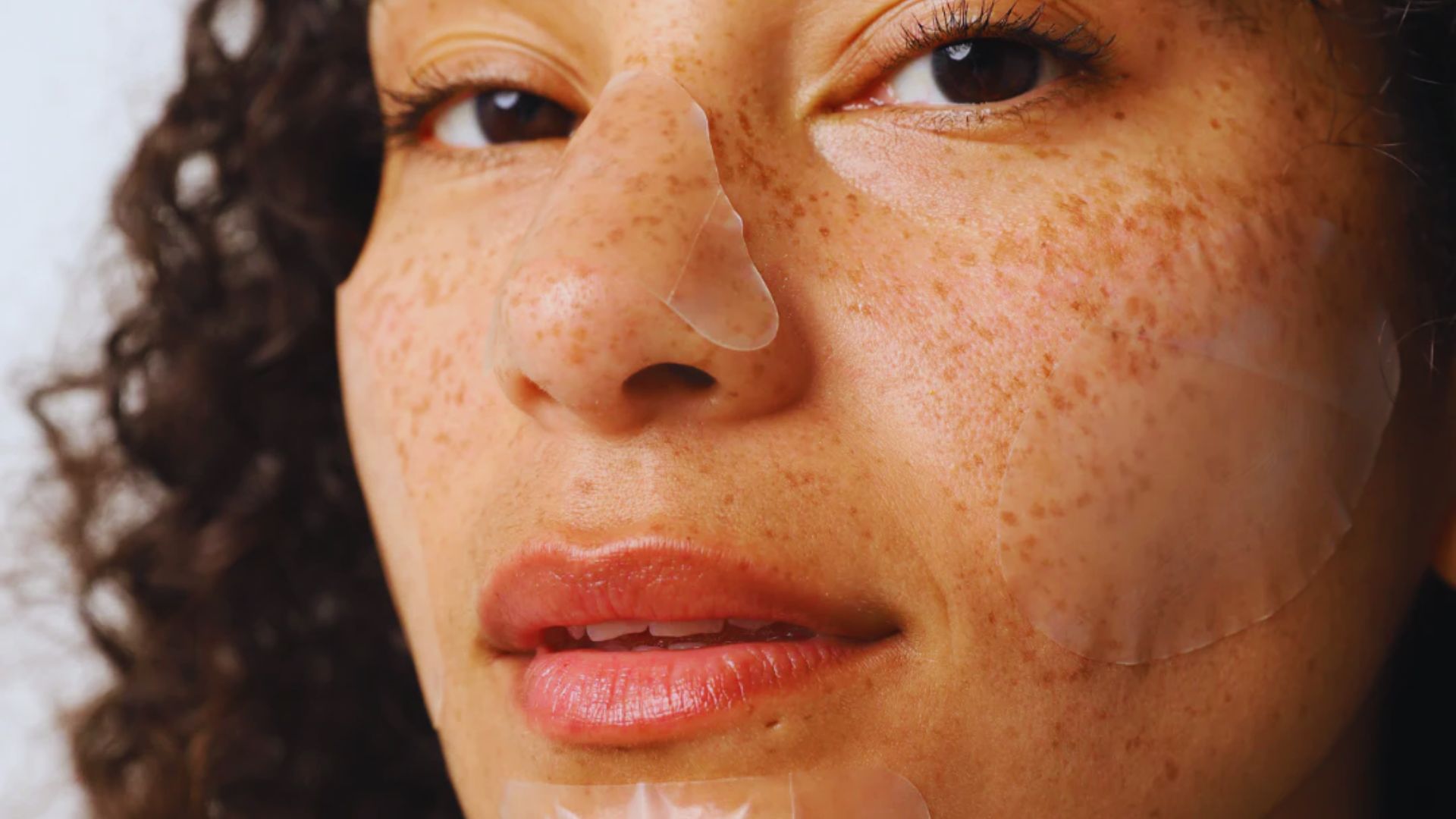 When to Avoid Using a Pimple Patch