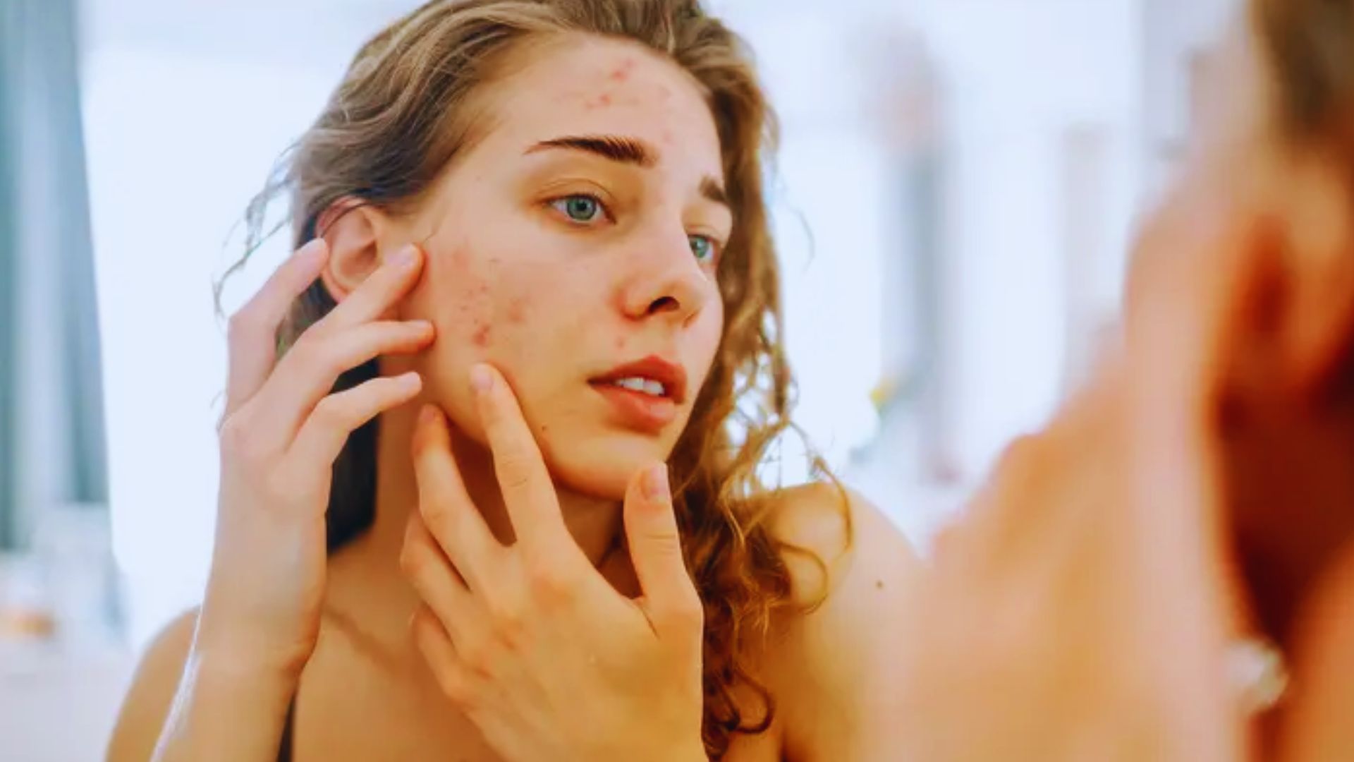 A woman gazes at her reflection in the mirror, focusing on her skin during an Adapalene purging phase.