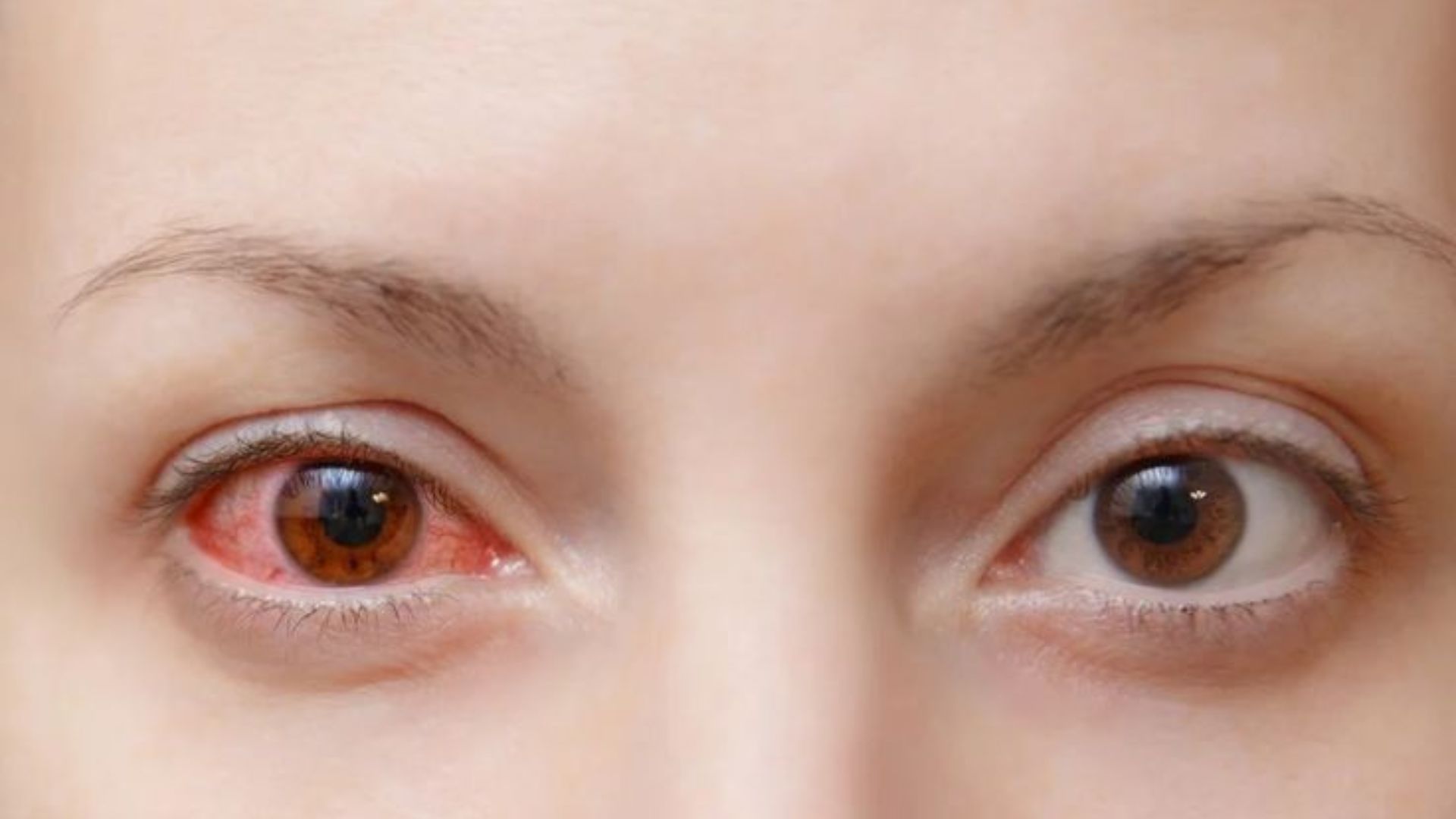 A woman with striking red eyes, one of which is prominently red, gazes directly at the viewer.