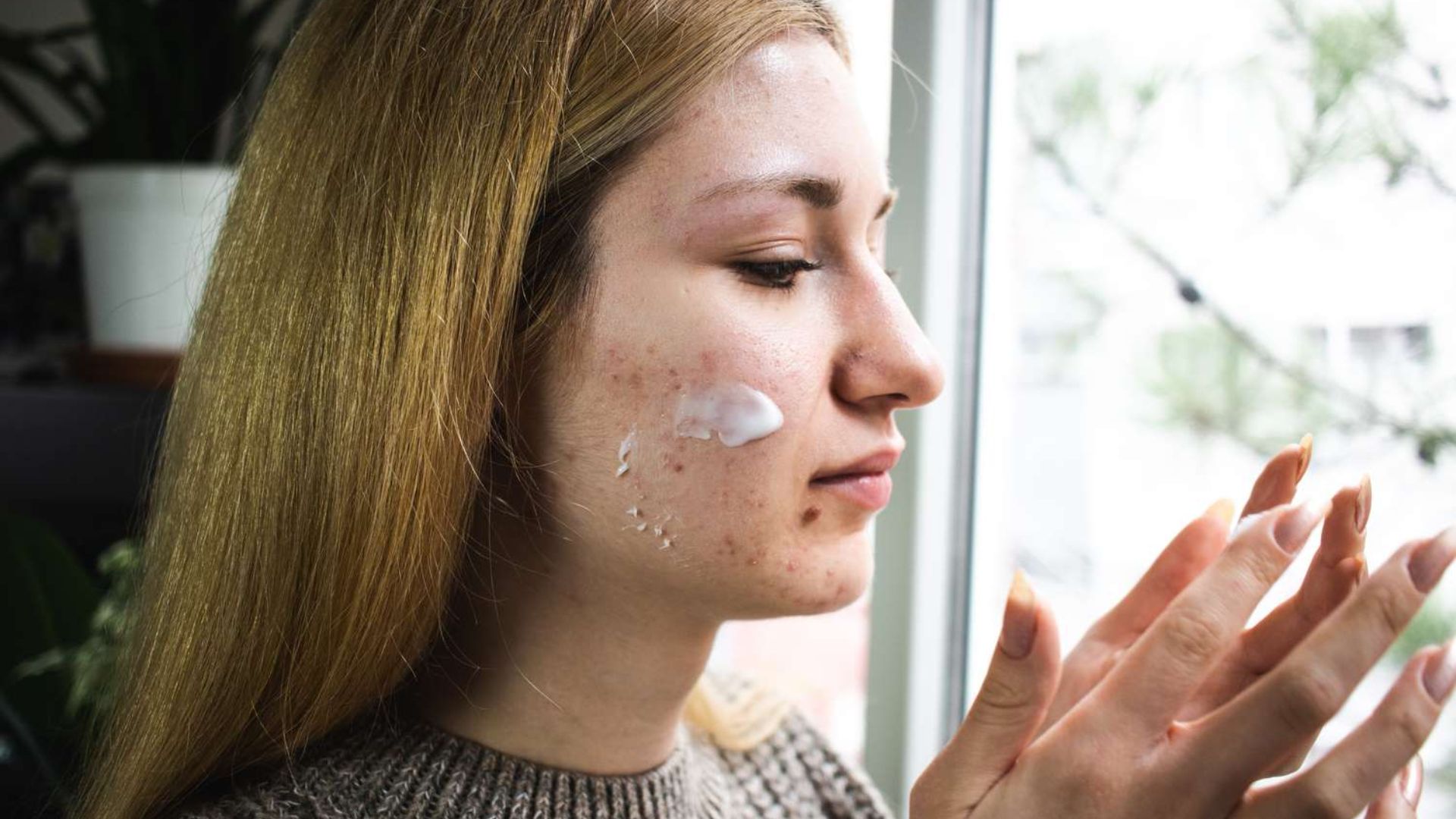 A woman examines her face while applying cream, reflecting on skincare and the effects of tretinoin purging.
