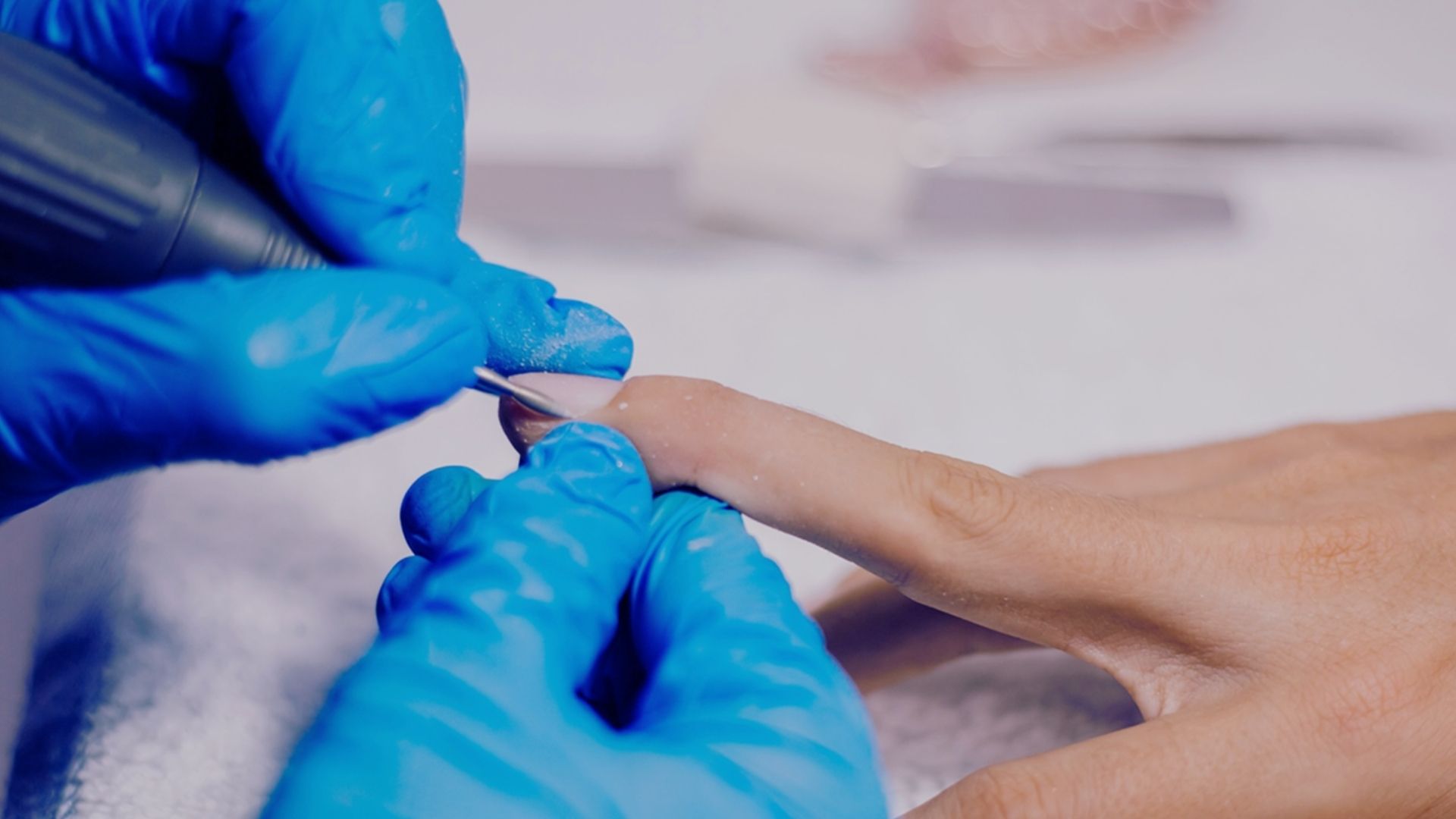 Aggressive Nail Procedures