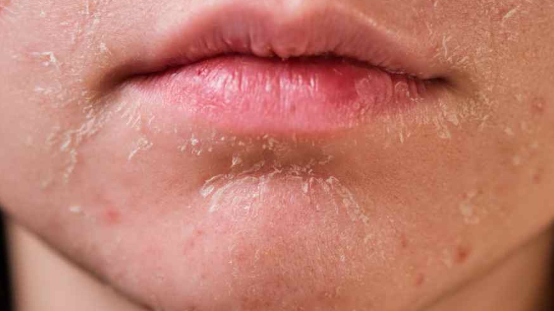 Close-up of a woman's face highlighting her lips, which are covered in a thick layer of white substance.