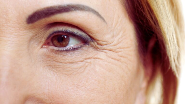 A close-up of a woman’s face showing prominent wrinkles, highlighting her age and life experiences.
