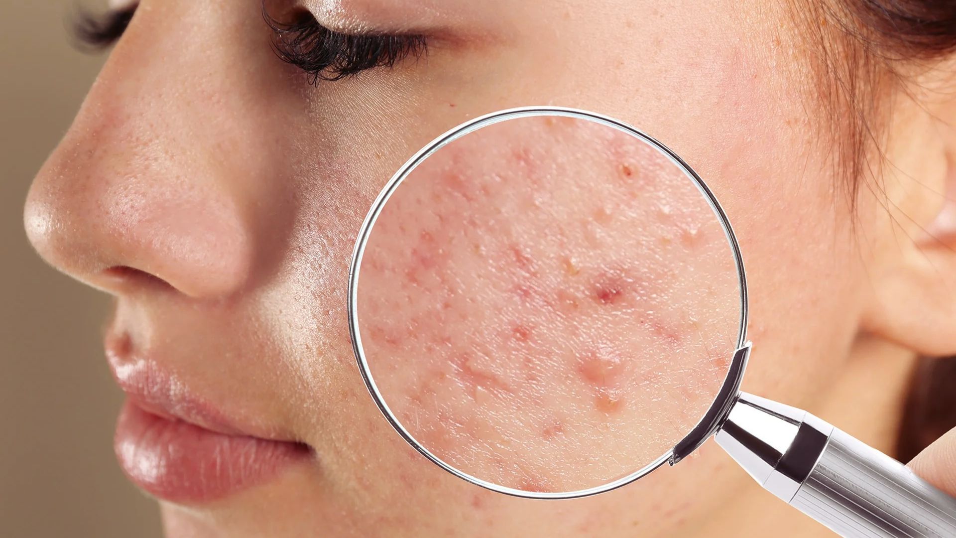 A woman examines her skin closely with a magnifying glass, focusing on details for skincare analysis.