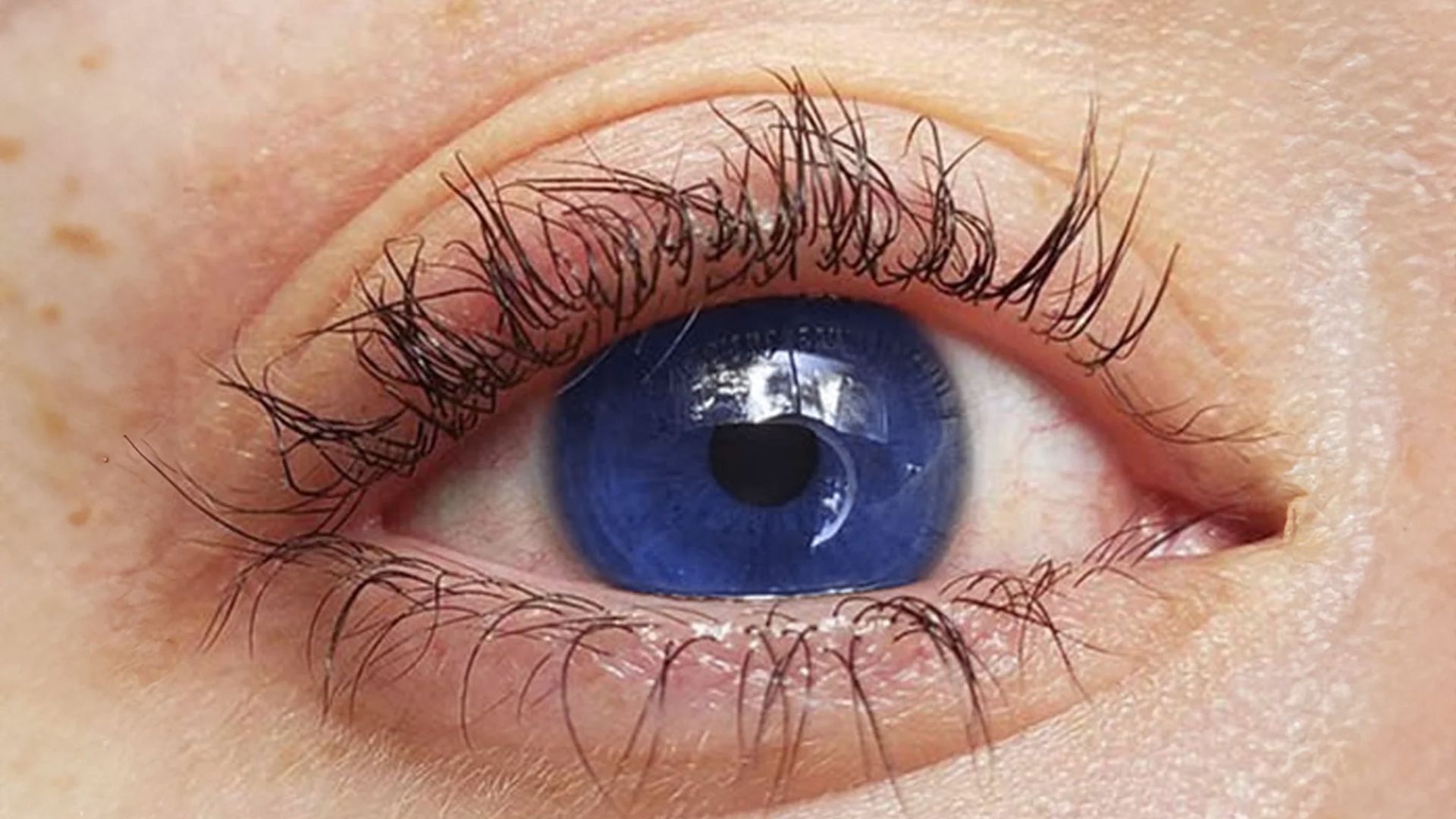 A close-up of a person's eye featuring vibrant blue contact lenses.