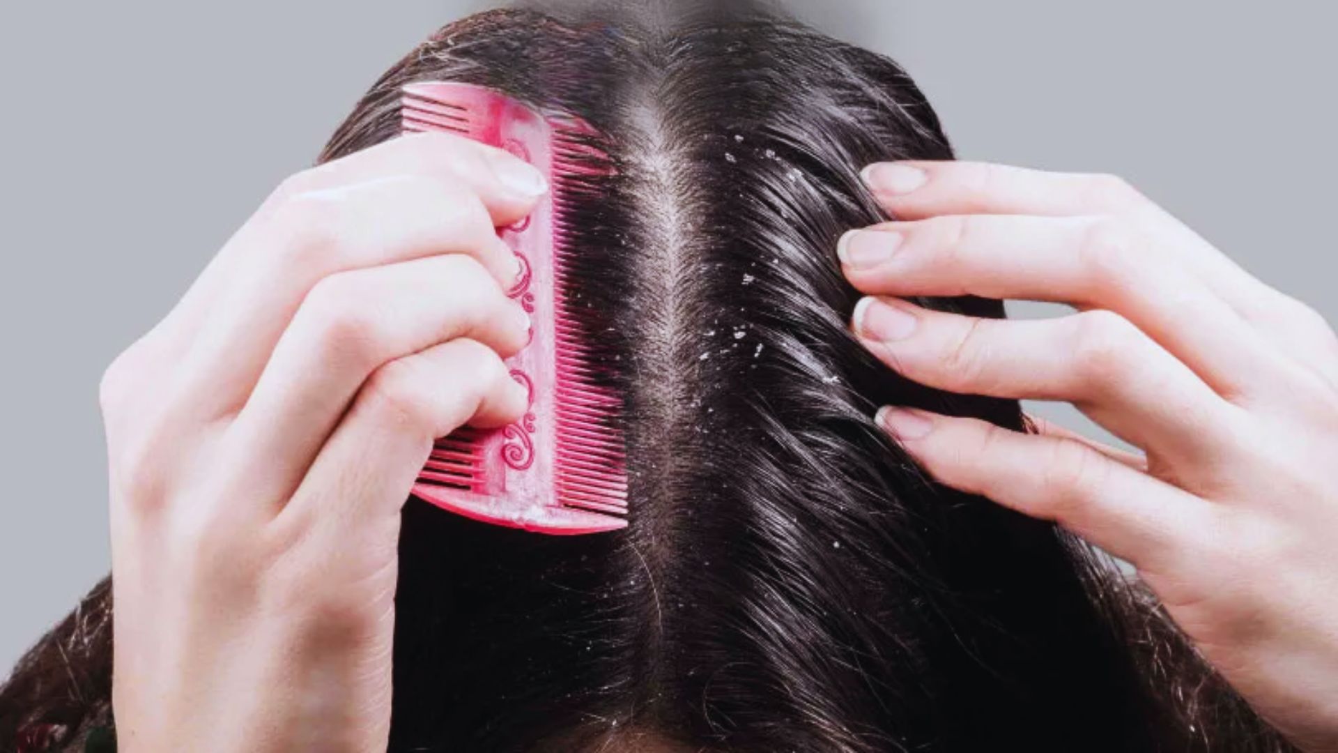 A person using a comb to style their hair, focusing on grooming and personal care.
