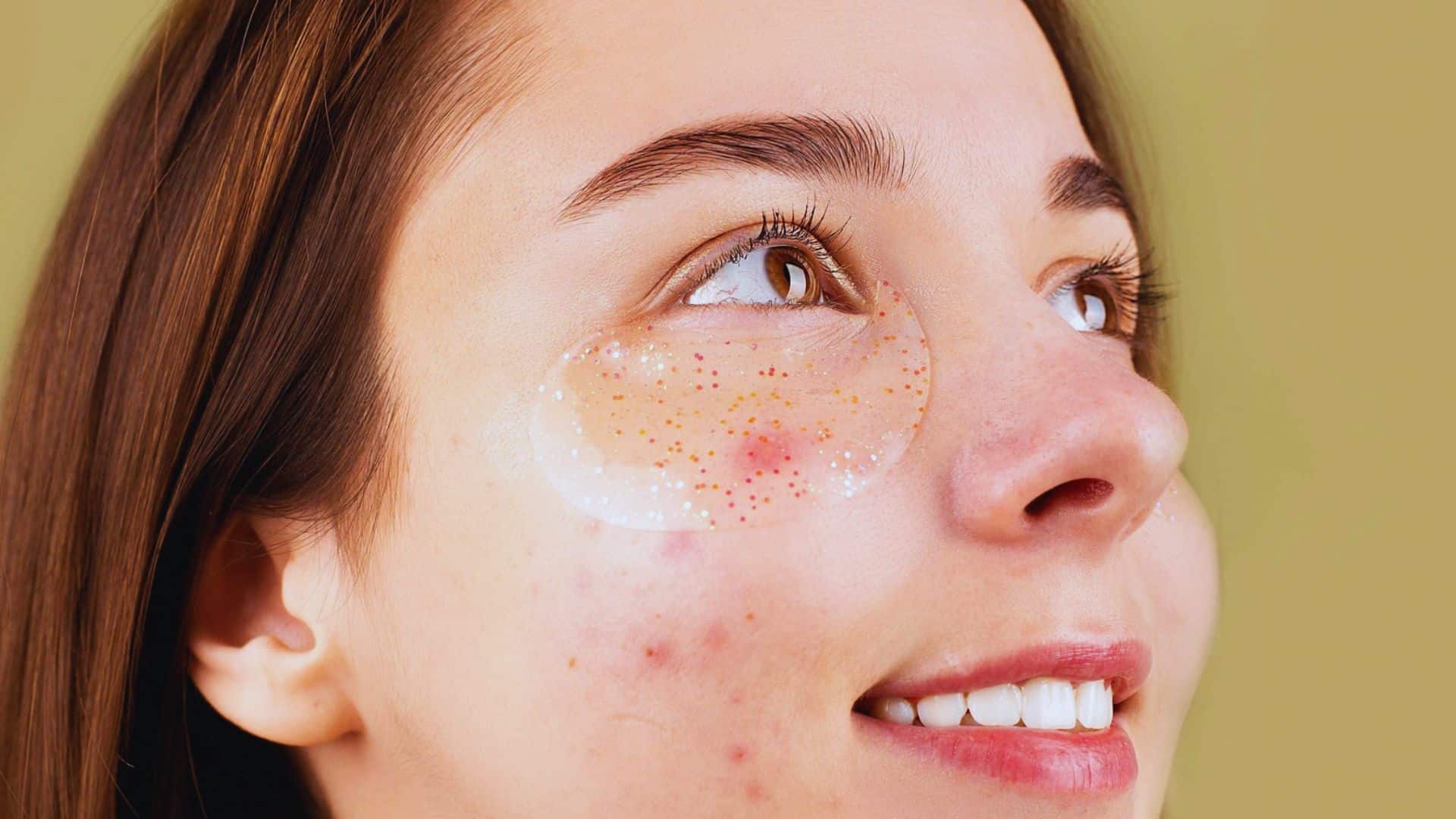 A woman with a noticeable patch of skin around her eye, highlighting a unique feature of her appearance.
