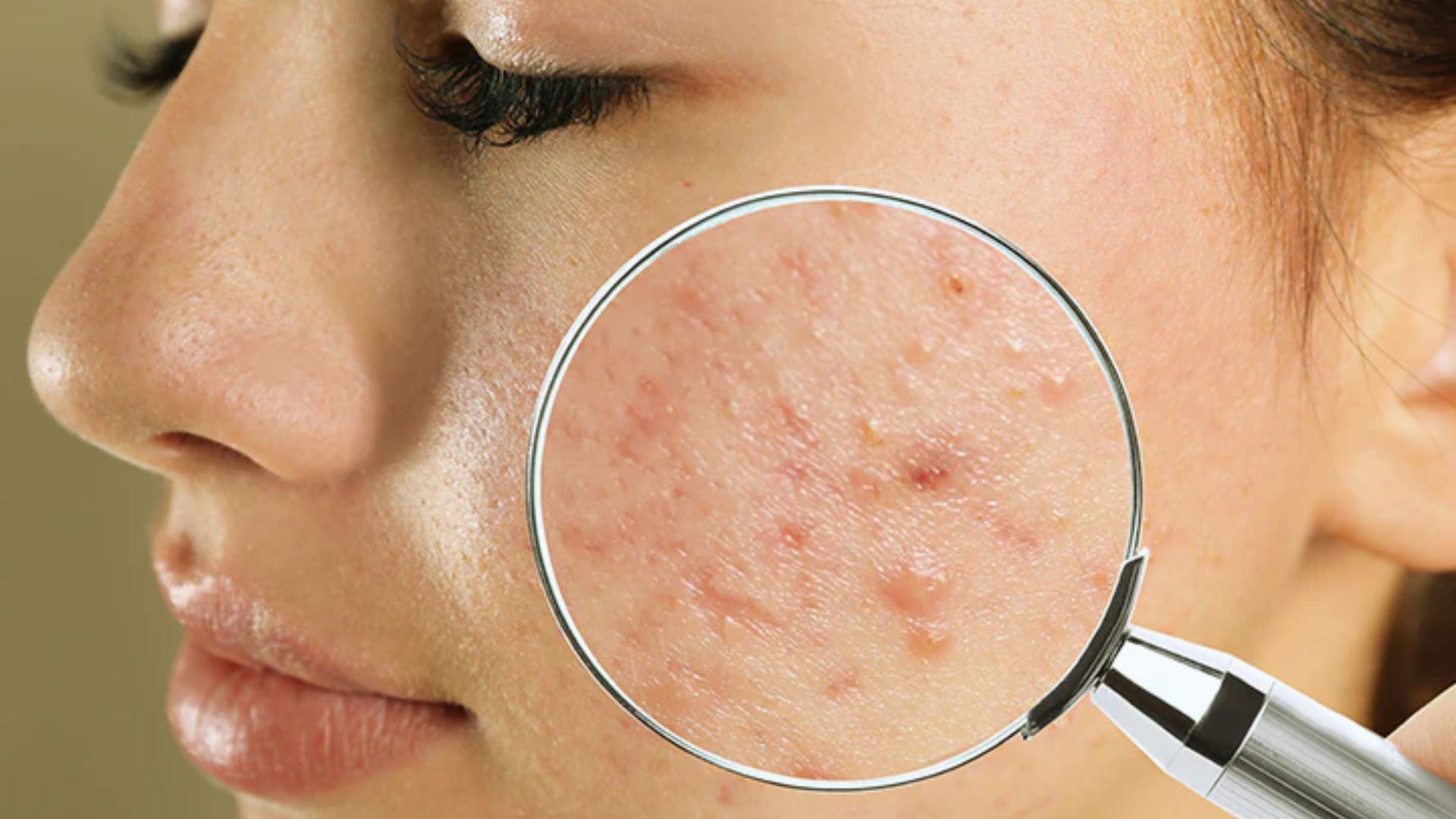 A woman examines her skin closely with a magnifying glass, focusing on details for skincare analysis.