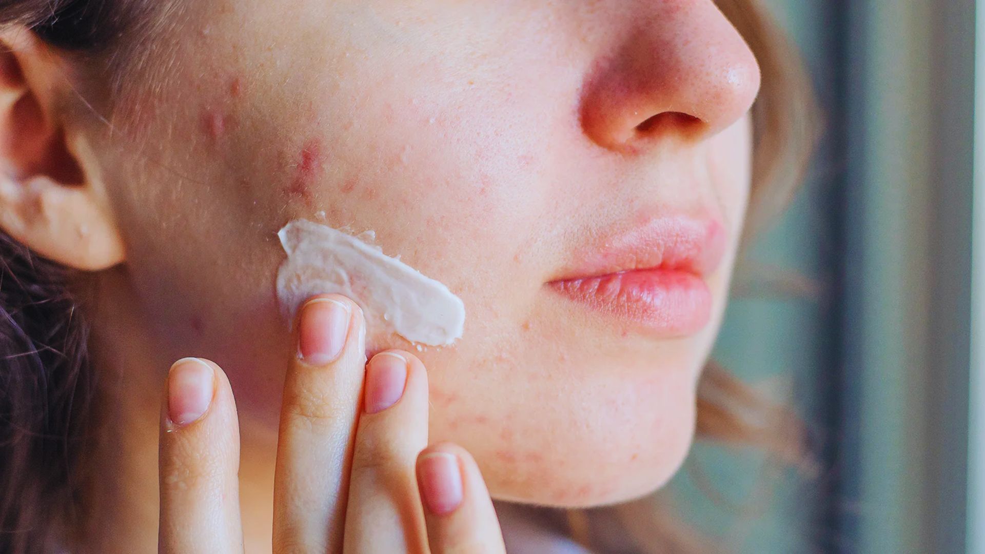 A woman applies cream to her face, focusing on skincare in a bright, well-lit bathroom setting.