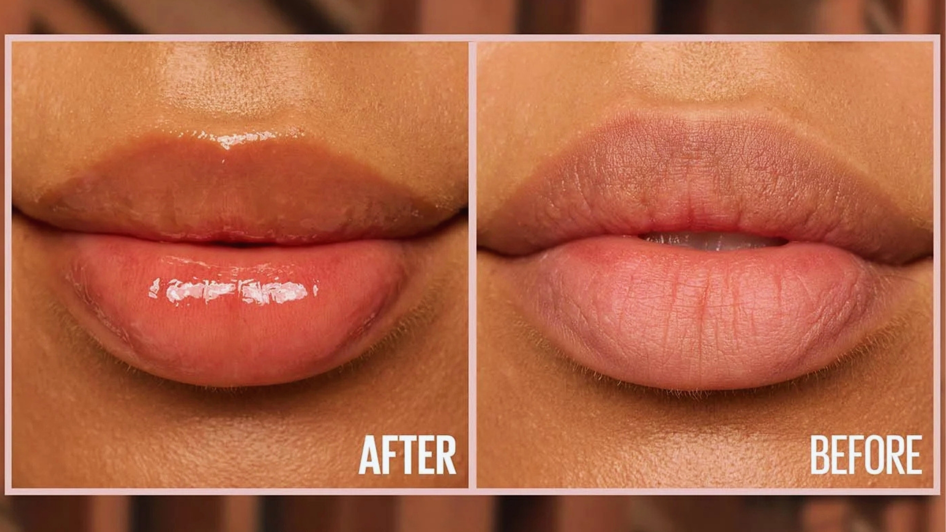 Side-by-side comparison of lips. Left: glossy, smoother lips labeled "After." Right: matte, textured lips labeled "Before." Highlighting a beauty transformation.
