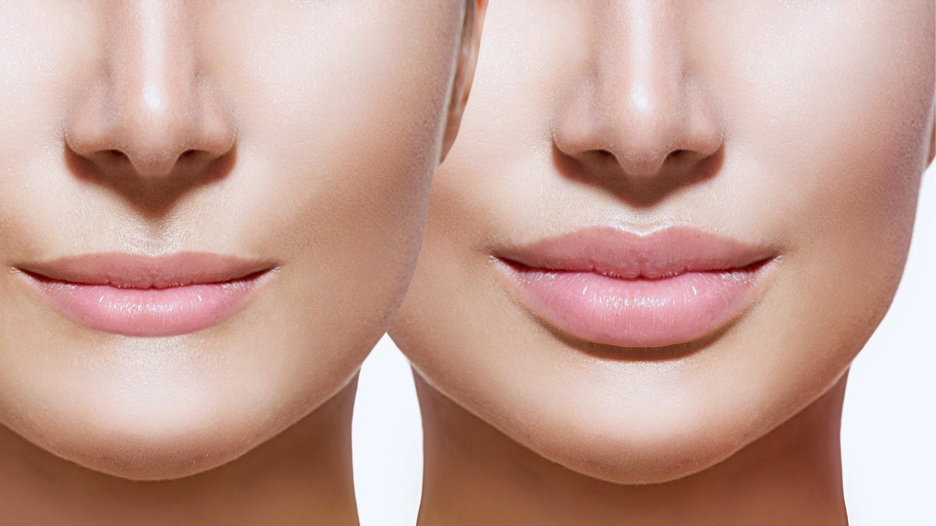 Two side-by-side close-ups of a woman's lower face show a comparison of lips before and after enhancement. The left image has thinner lips, and the right shows fuller, plumper lips. The skin tone is smooth and light.