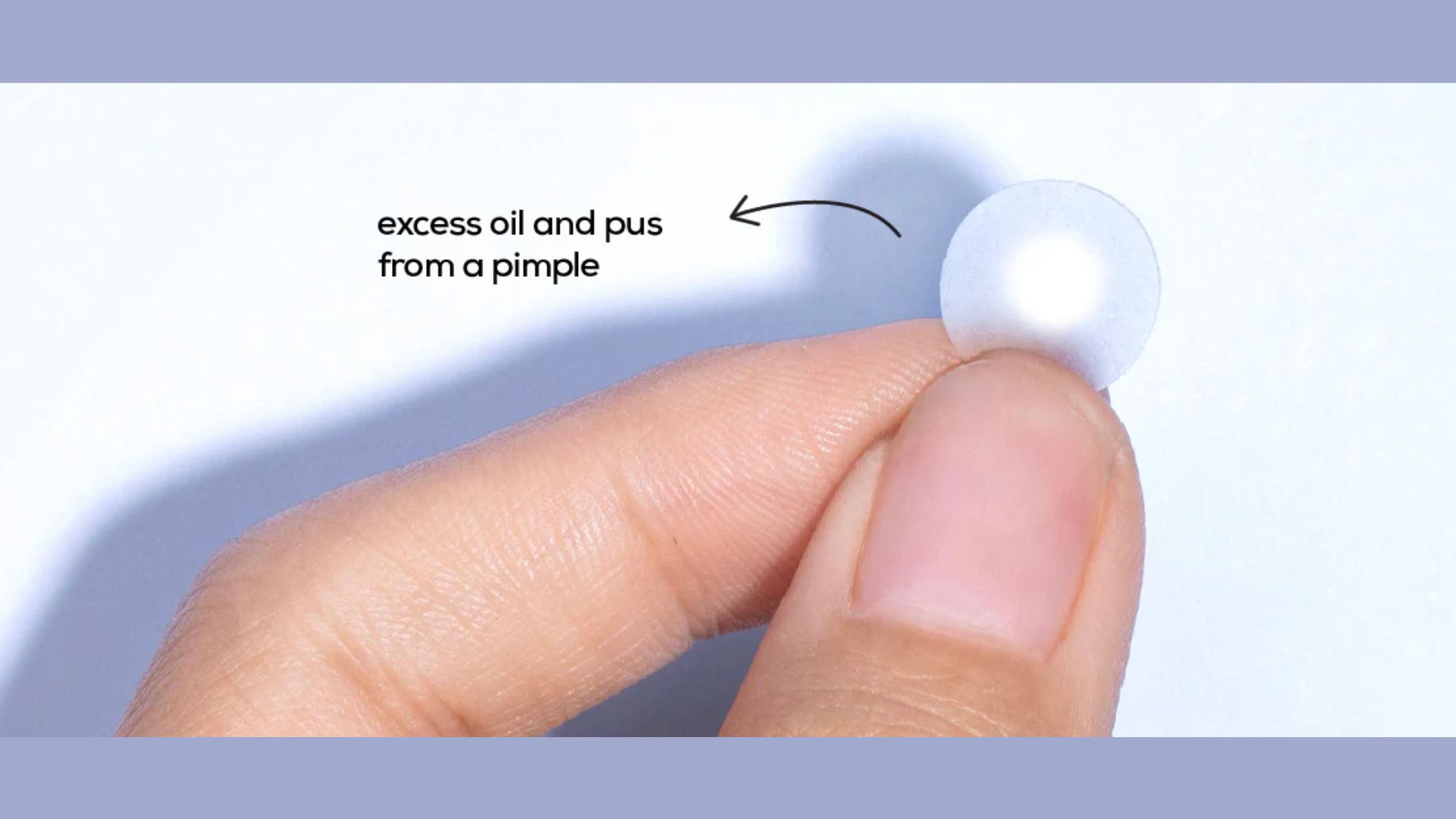 A hand holds a small, circular acne patch against a light background. Text reads "excess oil and pus from a pimple," with an arrow pointing to the patch.