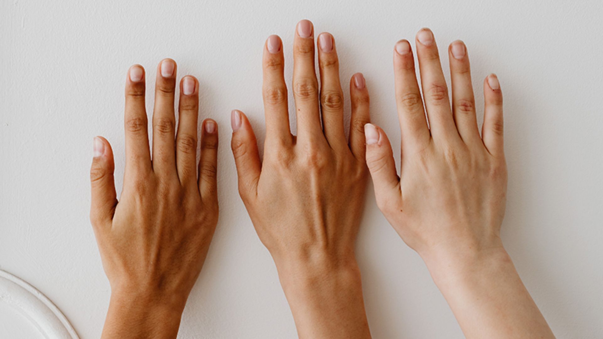 Three hands of varying skin tones rest side by side against a white background, symbolizing diversity and unity. Fingers are relaxed and slightly spread.
