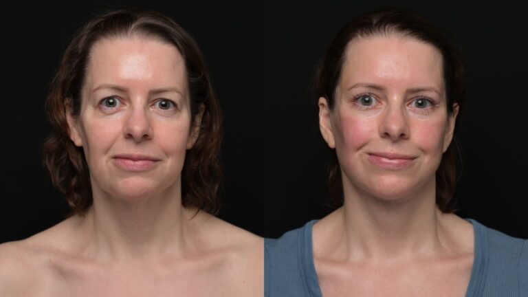 Two side-by-side portraits of the same woman. Left: neutral expression, bare shoulders. Right: slight smile, wearing a blue top. Black background.
