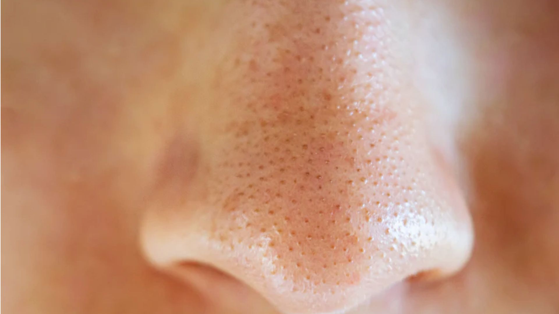 Close-up image of a nose with visible pores and natural skin texture, conveying a sense of realism and detail. The lighting highlights the skin's surface.