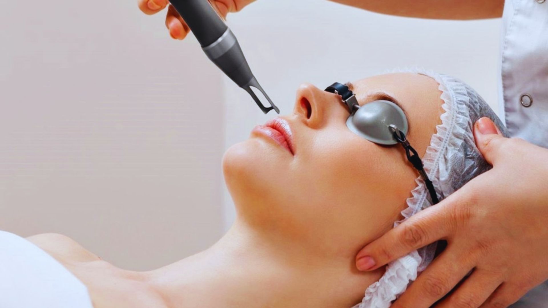 A person receiving laser skin treatment in a clinic. They wear protective goggles and a hairnet, with a professional using a laser device on their face.