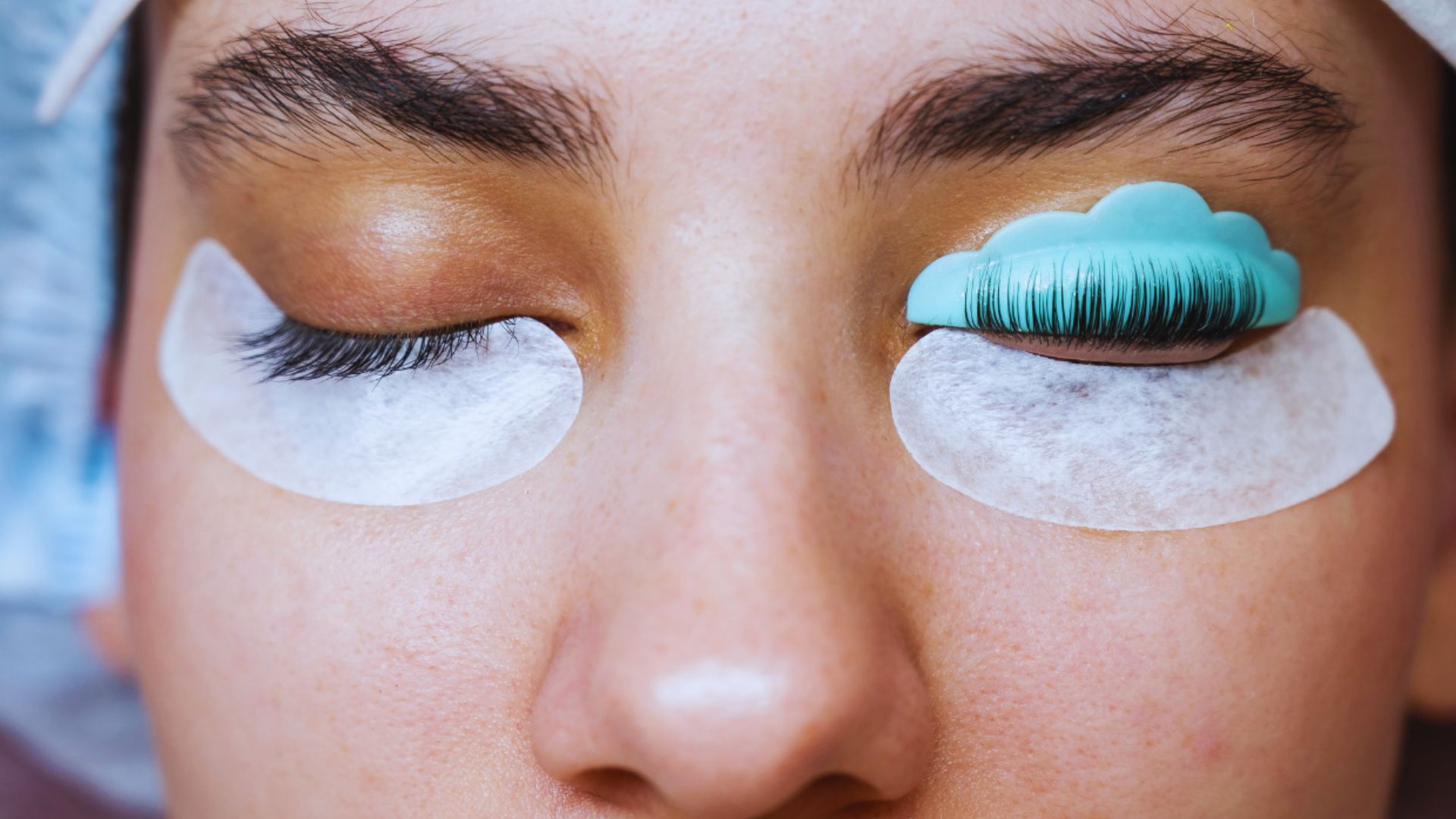 Close-up of a person undergoing a lash lift treatment. One eye is covered with a blue protective shield and curled lashes, the other with a white pad.