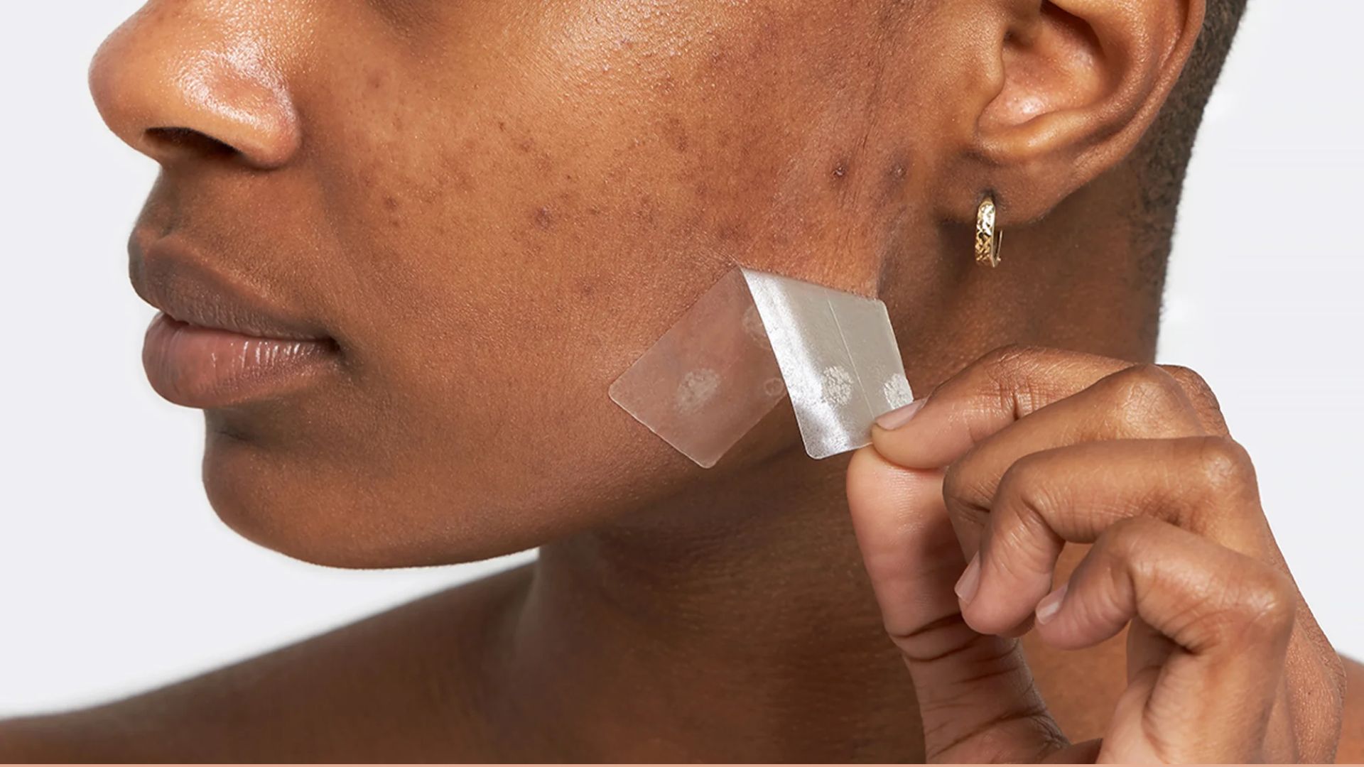 A person gently removes a clear adhesive patch from their cheek, revealing smoother skin. The image highlights acne treatment. The mood is focused and caring.