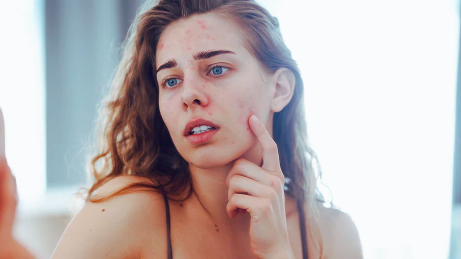 Young woman with acne looks at her reflection, touching her cheek. Her expression appears contemplative. The lighting is soft, creating a reflective mood.