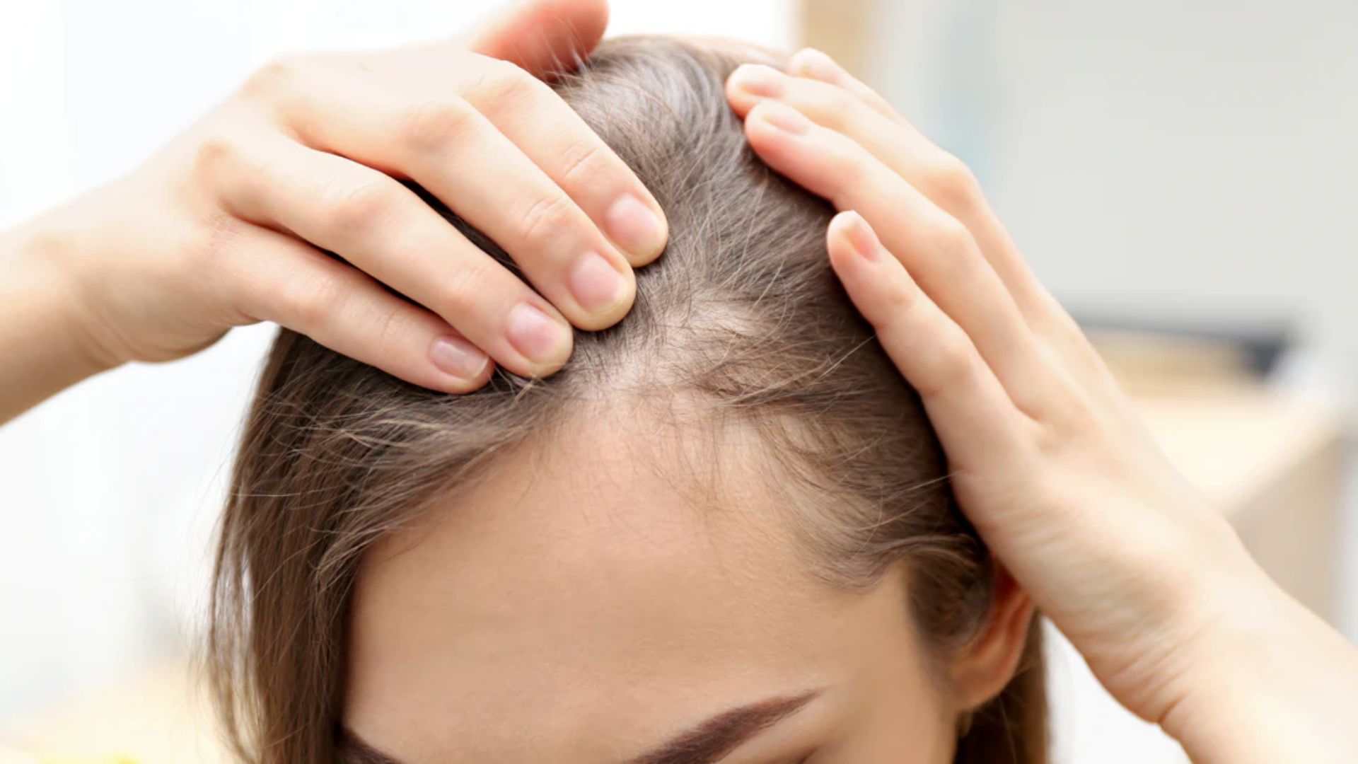 A person examines their scalp by parting hair with hands, focusing on a thinning area. The image conveys concern, suggesting hair loss or health awareness.