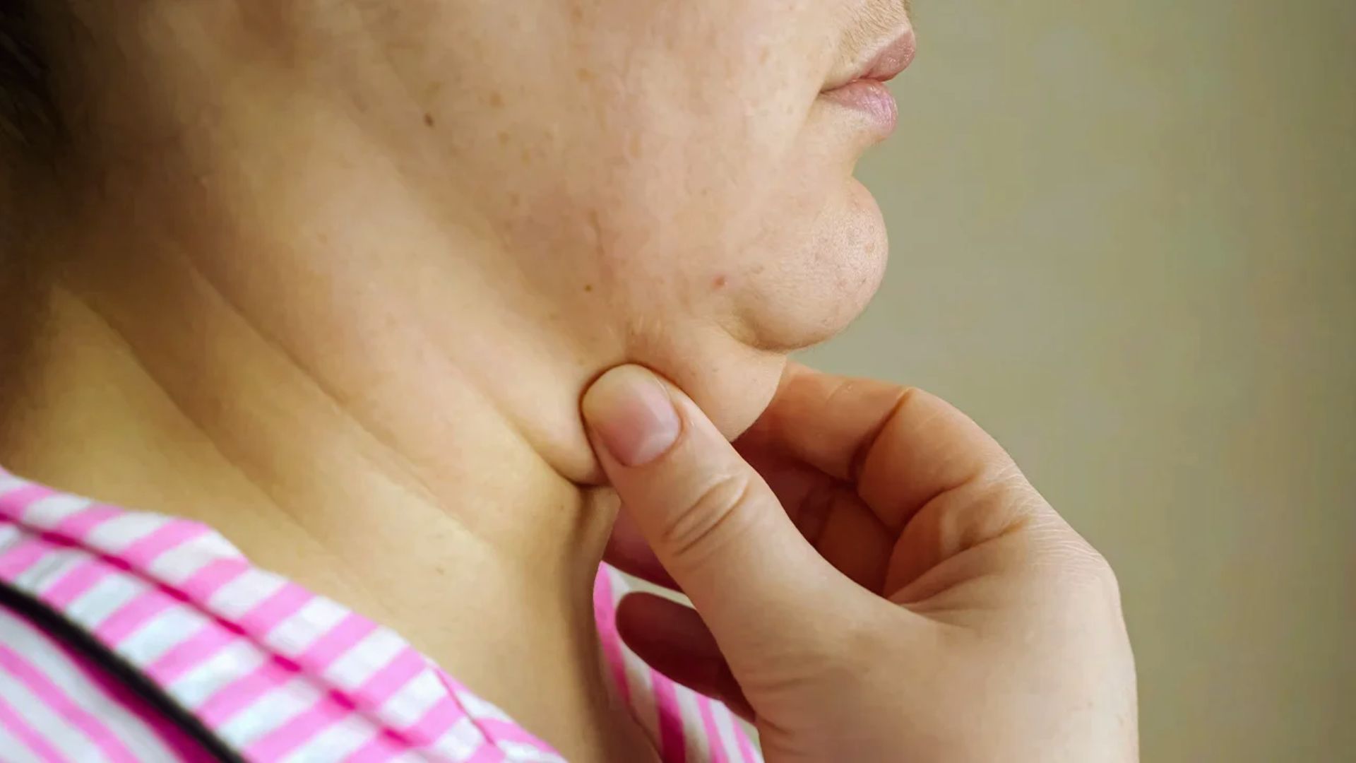 A close-up of a person in a pink striped shirt pinching their double chin, highlighting skin texture. The tone is neutral with a focus on natural features.