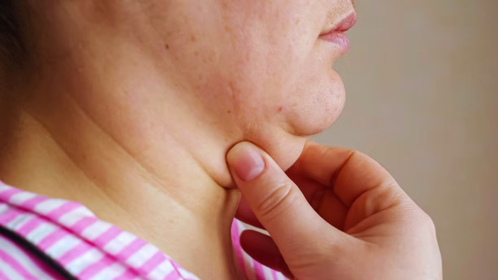 Close-up of a person pinching their double chin, wearing a pink striped shirt. The focus is on the chin, with a neutral background.