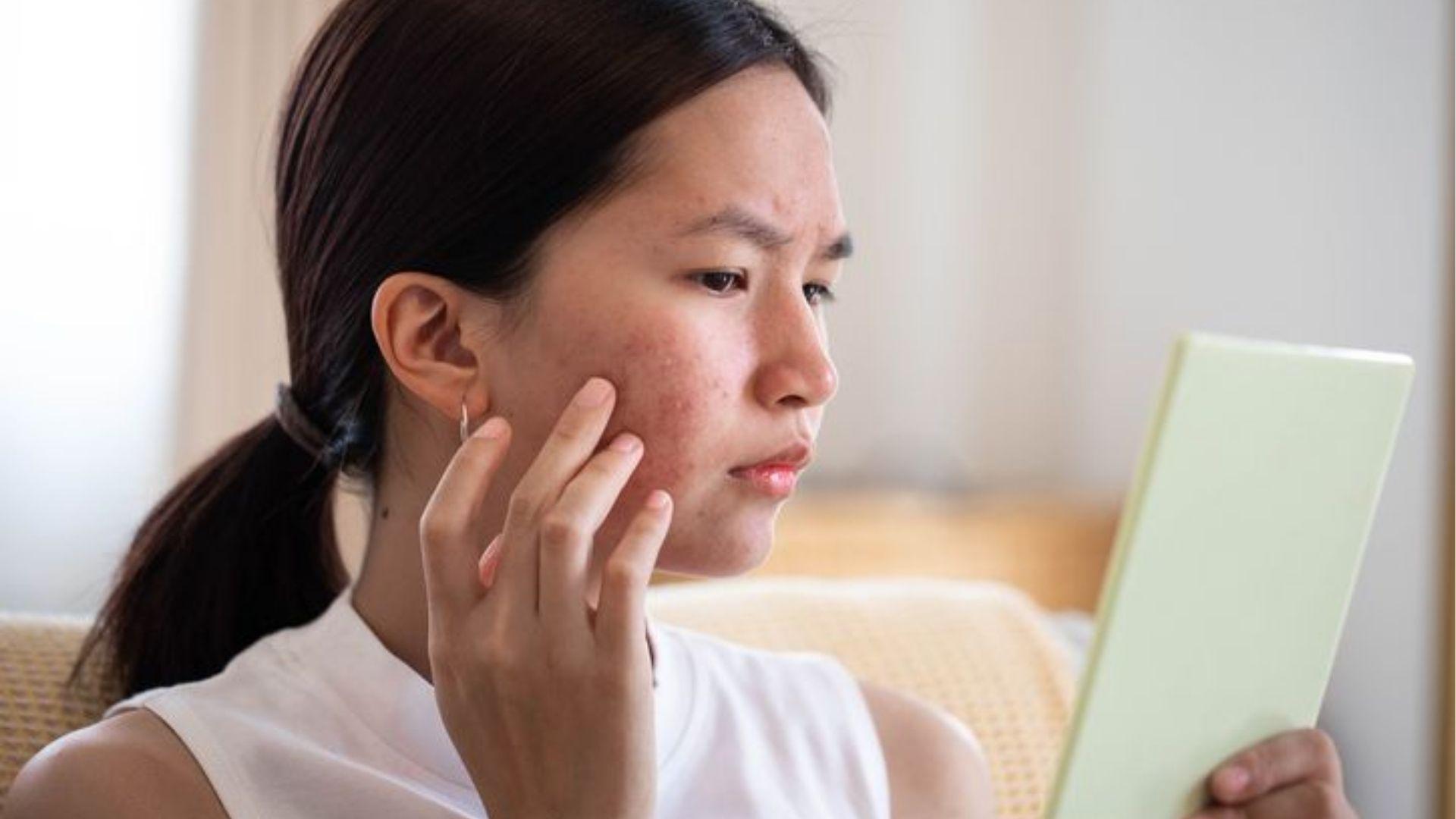 Woman examines facial acne in a mirror, stressed about skin flare-ups linked to hormonal changes.