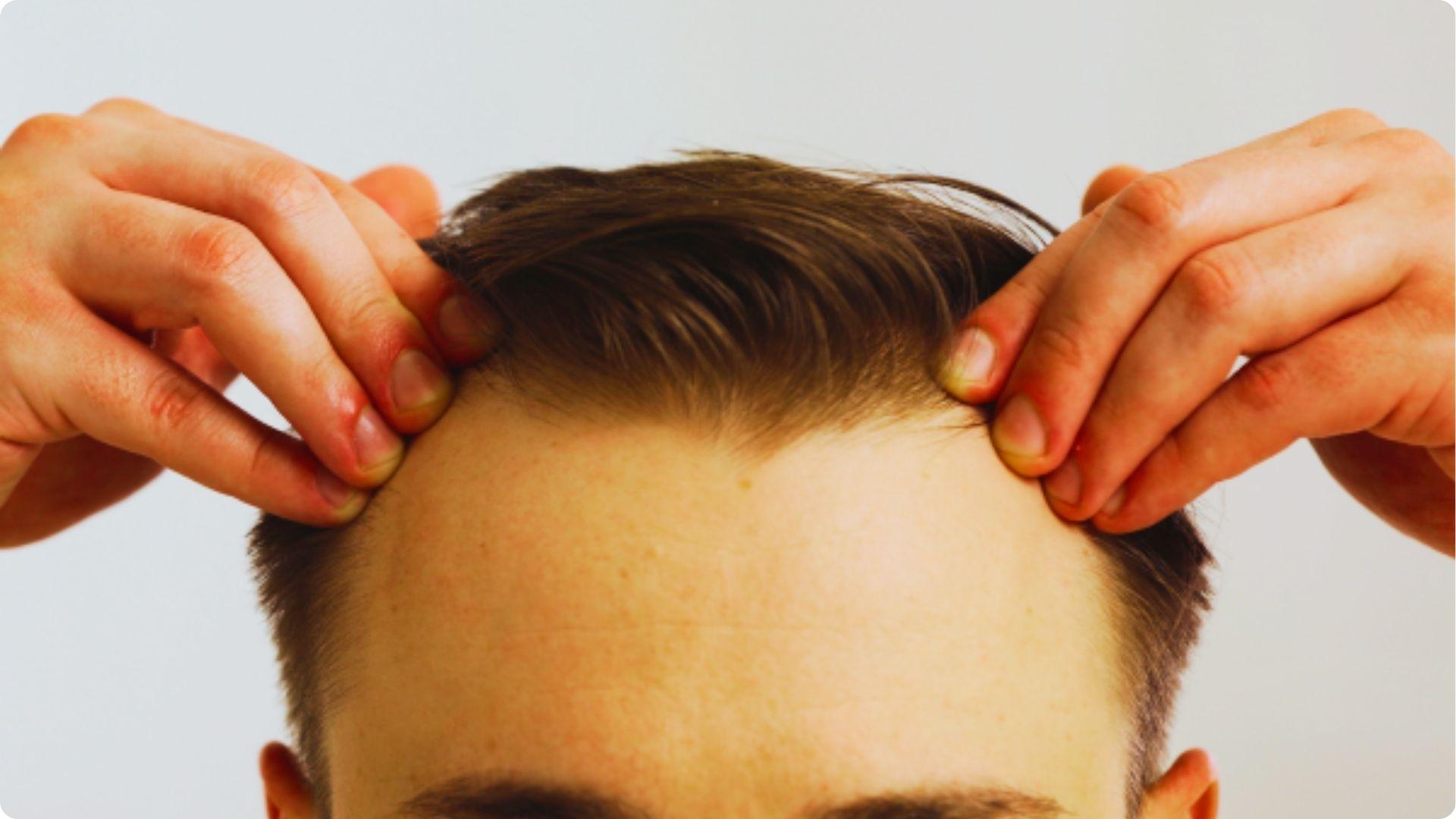 Close-up of a man pulling back his hair at the temples with both hands.