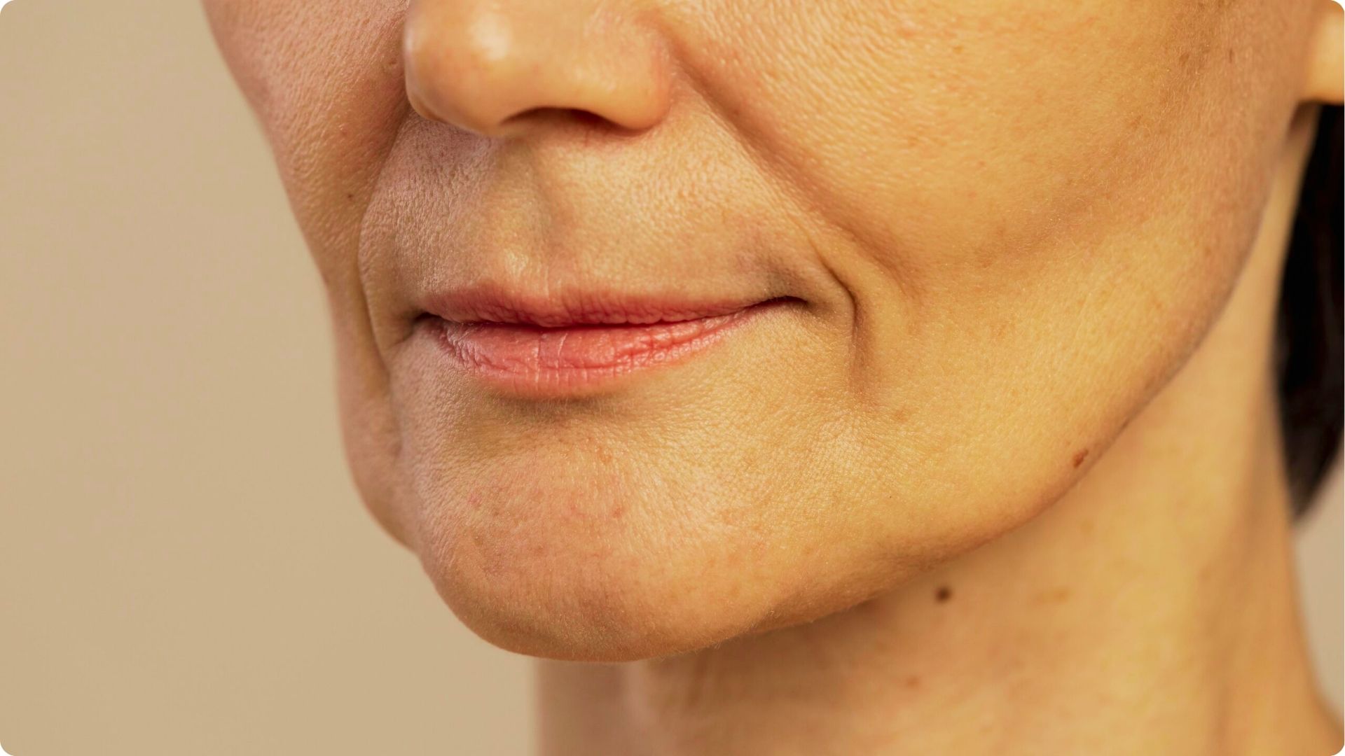 Close-up of a woman's lower face showing mild jowls and marionette lines around the mouth.