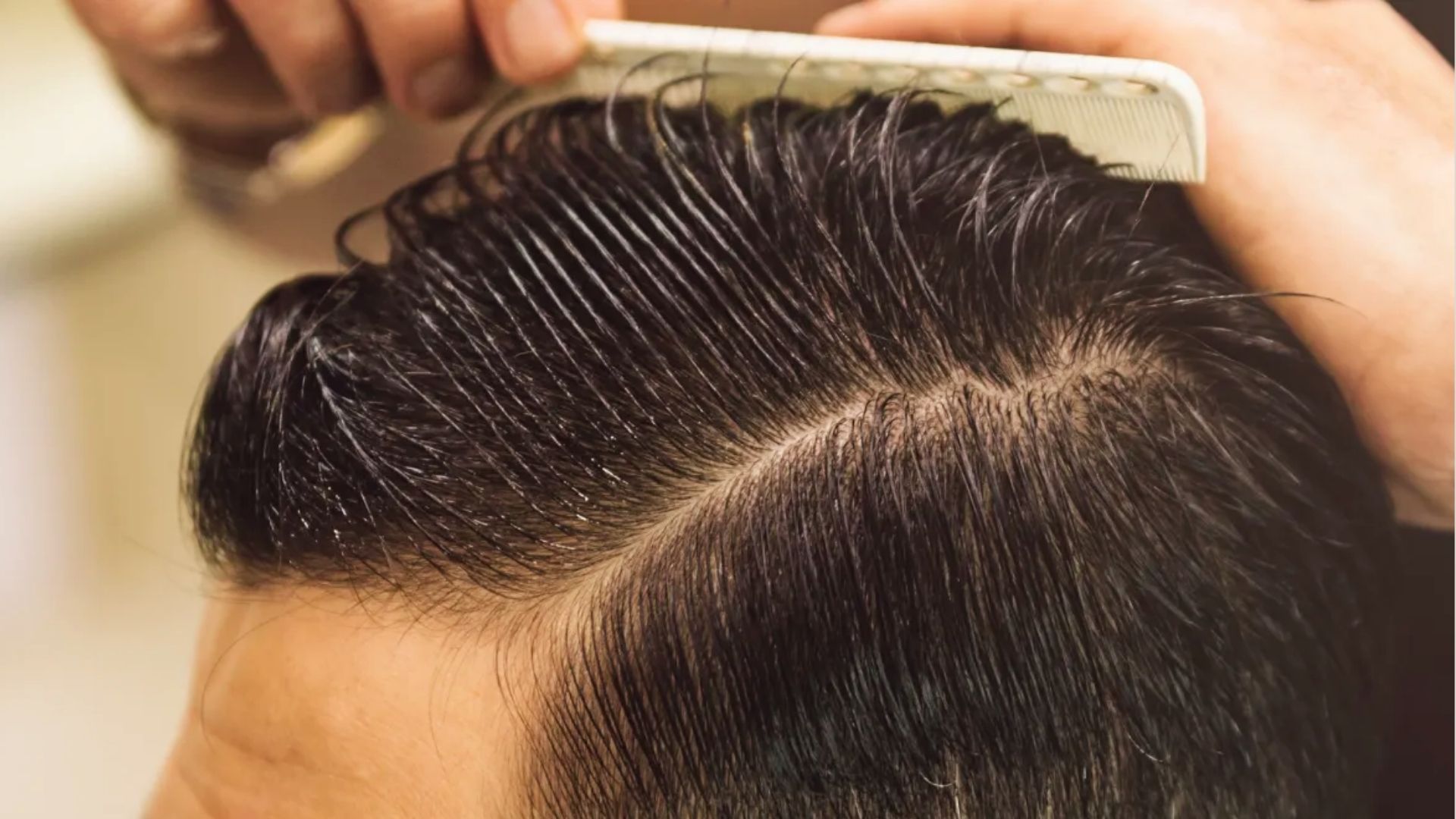 A person showing their hair while using hair oils as part of a natural routine to support healthy hair growth and reduce hair fall.