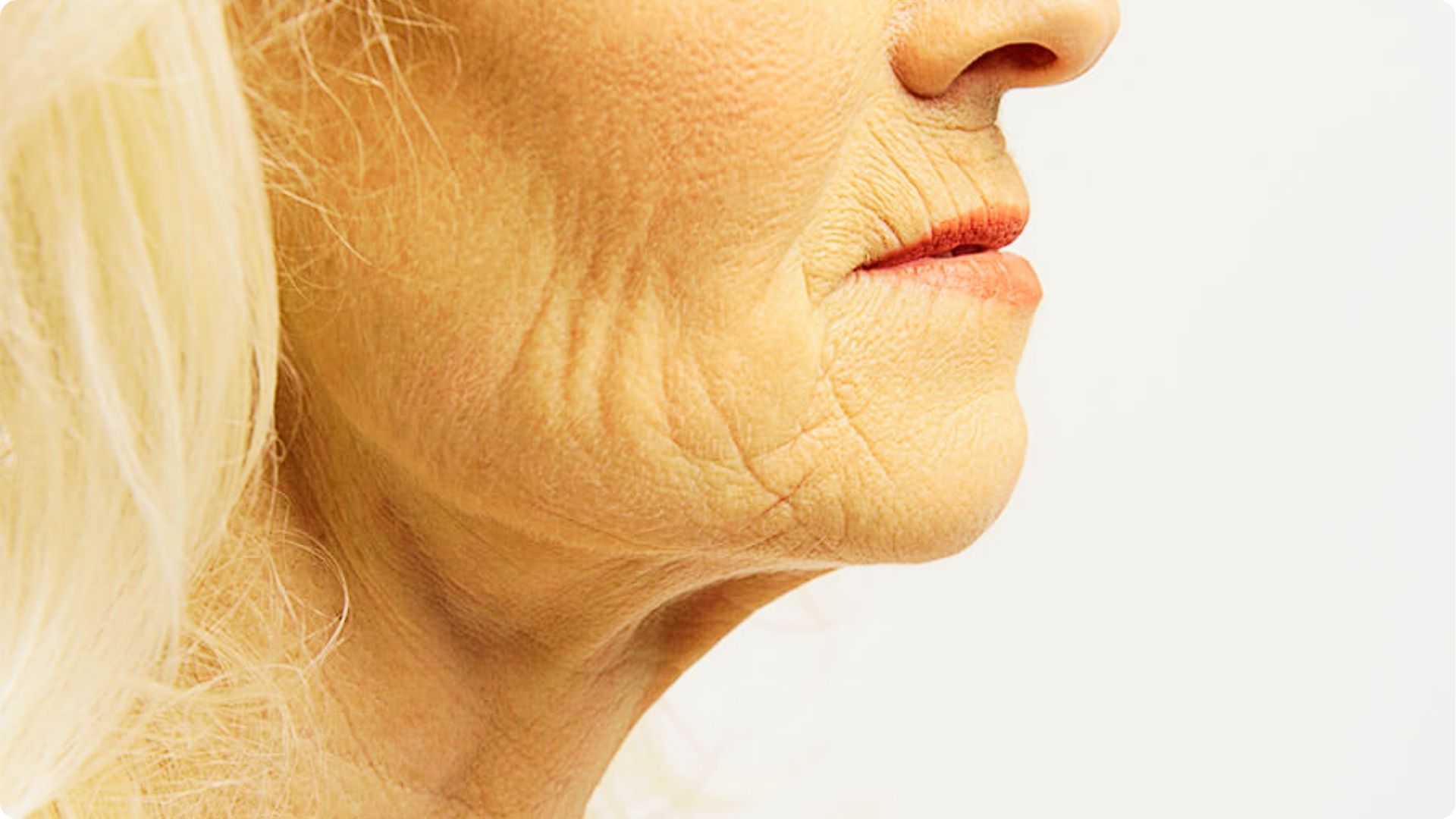 Side profile of an older woman’s jawline and neck showing visible crepey skin and fine lines.
