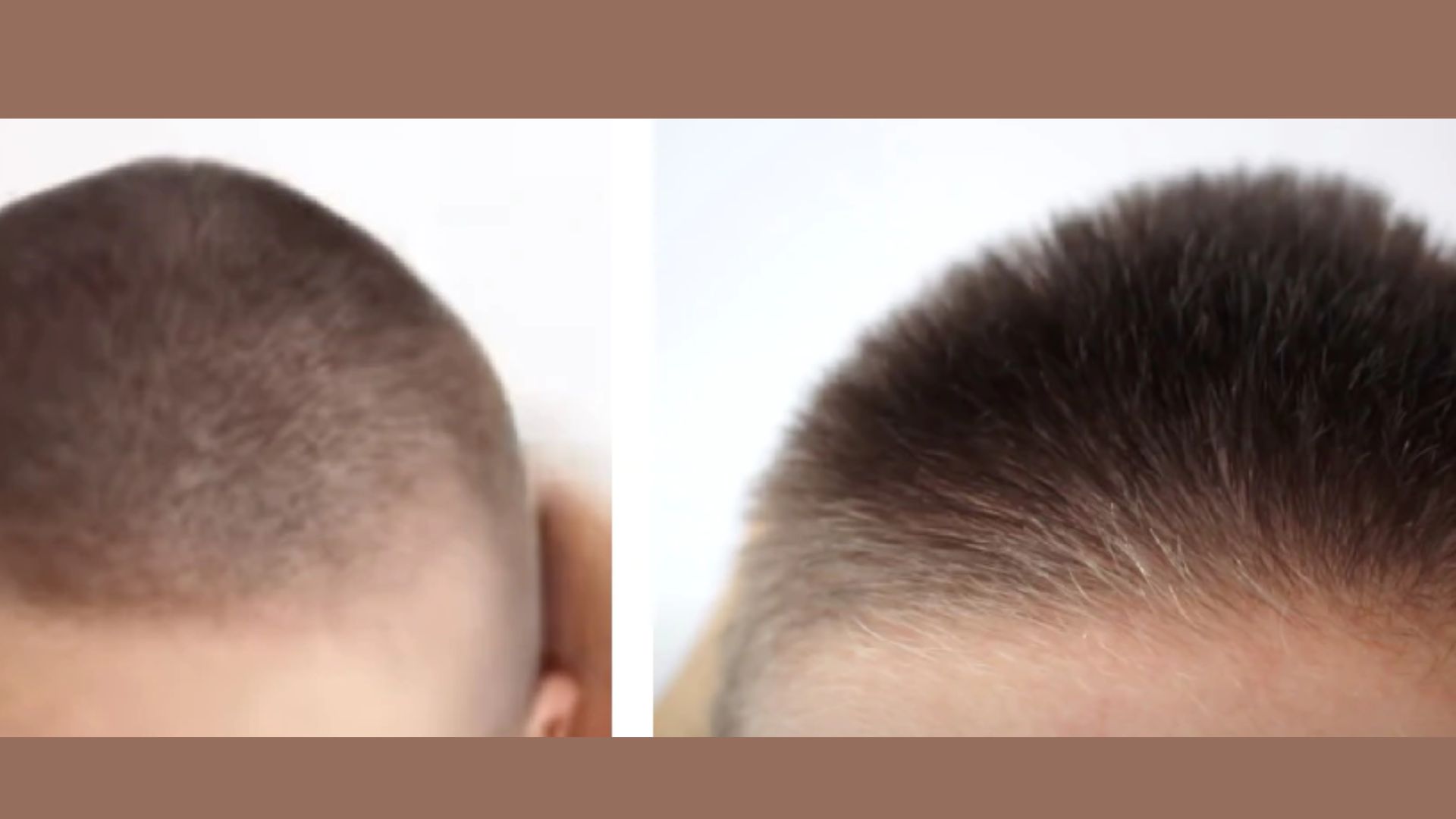 A side-by-side comparison of two hair looks showing thinner, weaker hair on one side and healthier, thicker, and shinier hair on the other side.