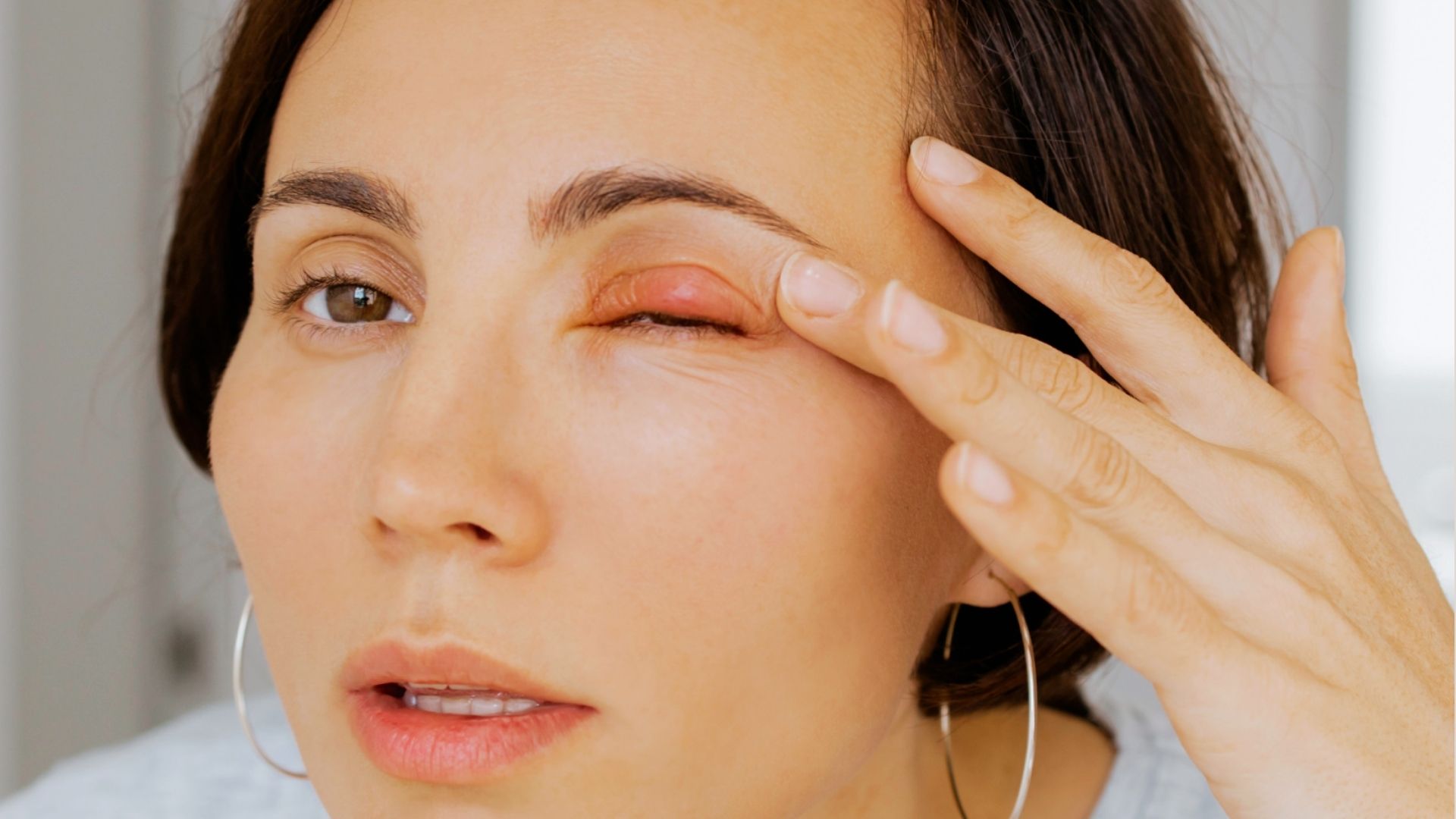 Person avoiding touching or squeezing a small bump under the eye to prevent irritation or infection.
