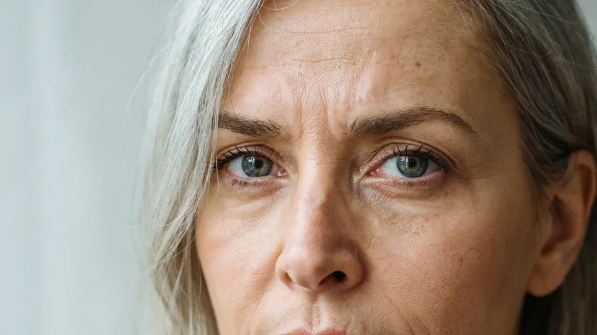 Close-up of a woman with gray hair, highlighting her frown lines and the effects of aging on skin texture.