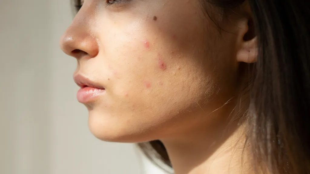 Common causes that contribute to hyperpigmentation.