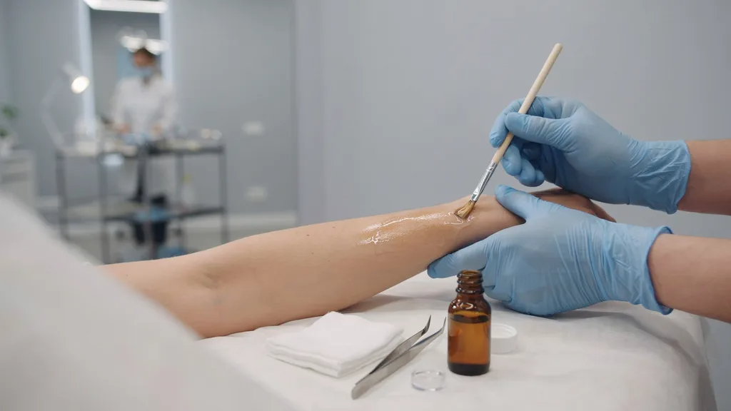 Close-up of chemical peel being professionally applied to elbows for skin brightening.