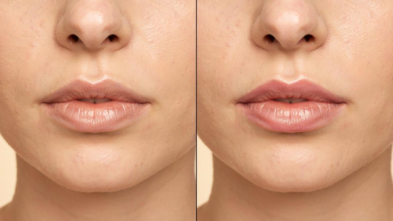 Before and after appearance of natural lip blushing results